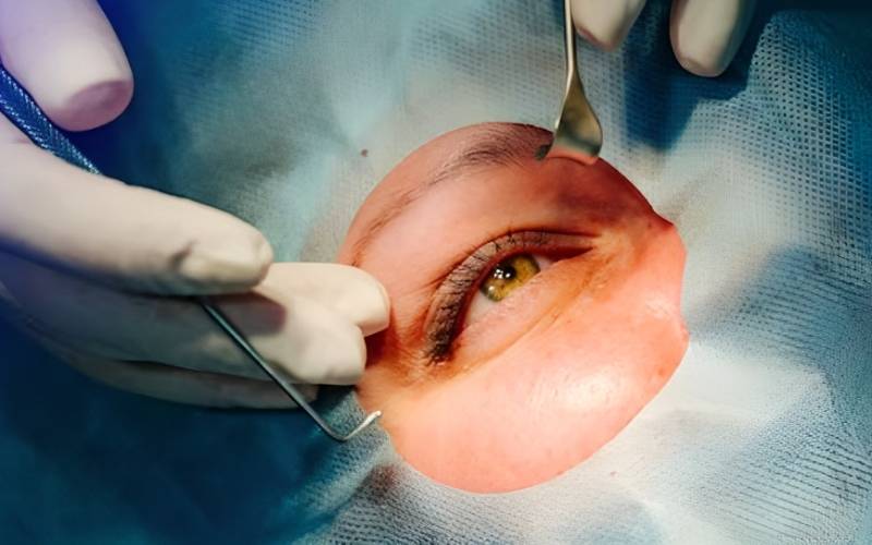 how much does lasik cost