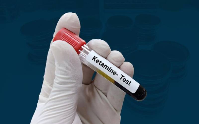 ketamine treatments los angeles